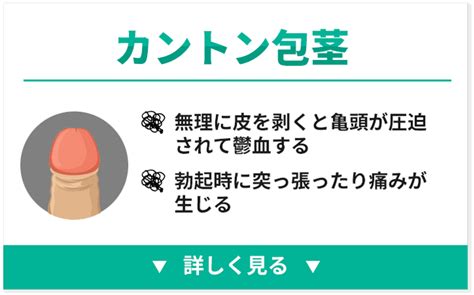 かんとんほう|嵌頓（カントン）包茎ってどんな包茎？正しい知識と。